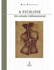 Escoliose, A - Um Estudo Tridimensional