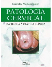 Patologia Cervical