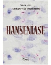 Hanseniase Hanseniase