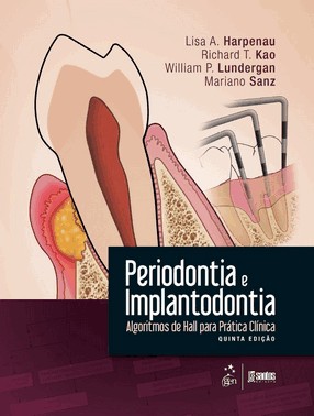 Periodontia E Implantodontia - Algoritmos De Hall Para Prática Clínica - 05Ed/16