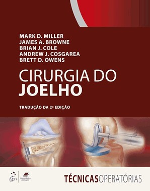 Cirurgia Do Joelho