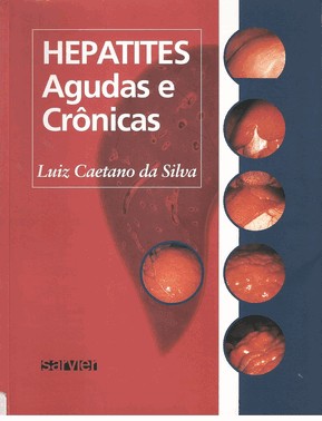 Hepatites Agudas e Crônicas