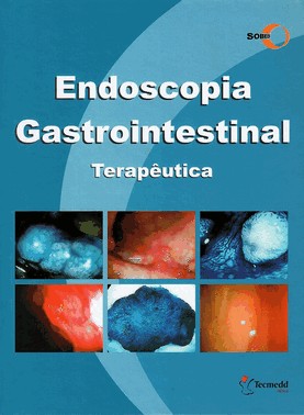Endoscopia Gastrointestinal - Terapeutica