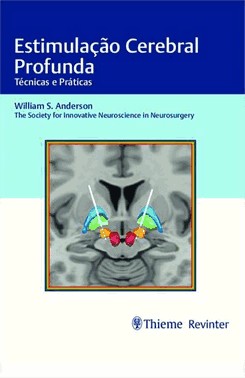 Estimulacao Cerebral Profunda