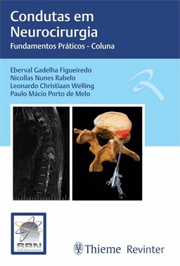 Condutas Em Neurocirurgia - Fundamentos Práticos - Coluna - 01Ed/22