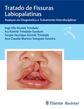 Tratado De Fissuras Labiopalatinas - Avancos No Diagnostico E Tratamento Interdisciplinar - 01Ed/24