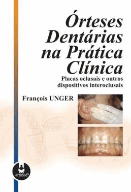 Orteses Dentarias Na Pratica Clinica