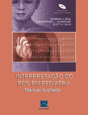 Interpretacao Do Ecg Em Pediatria
