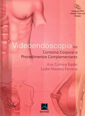 Videoendoscopia No Contorno Corporal E Procedimentos Complementares