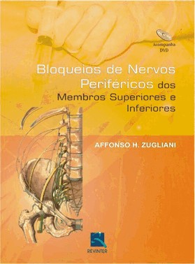 Bloqueios De Nervos Perifericos Dos Membros Superiores Inferiores
