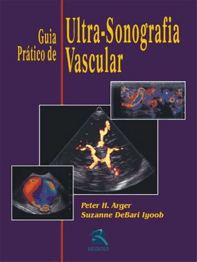 Guia Pratico De Ultrassonografia Vascular