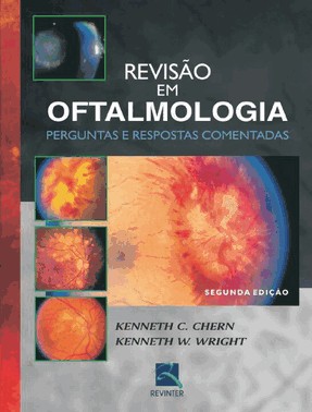 Revisao Em Oftalmologia Revisao Em Oftalmologia