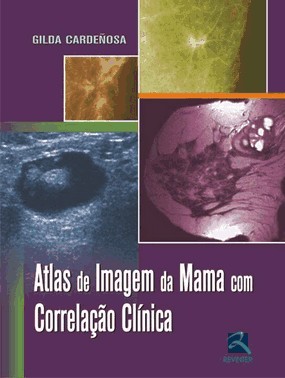 Atlas De Imagem Da Mama Com Correlacao Clinica