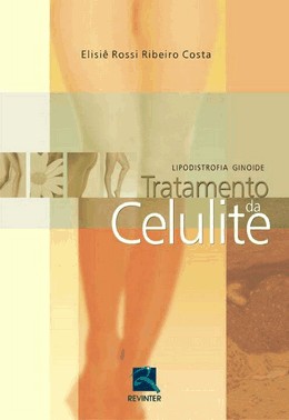 Tratamento Da Celulite