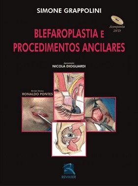 Blefaroplastia E Procedimentos Ancilares