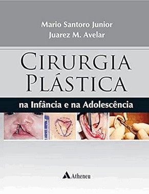 Cirurgia Plastica Na Infancia E Na Adolescencia - 01Ed/18