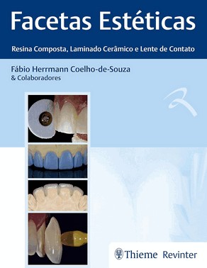 Facetas Estéticas