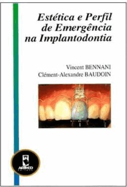 Estetica E Perfil De Emergencia Implant.