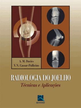 Radiologia Do Joelho