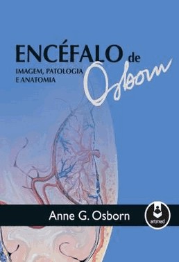 Encefalo De Osborn: Imagem, Patologia E Anatomia