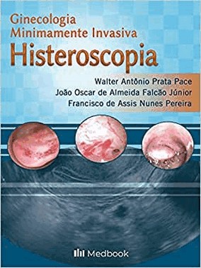 Histeroscopia - Ginecologia Minimamente Invasiva