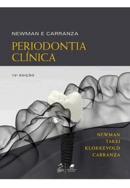 Periodontia Clinica - 13 Ed