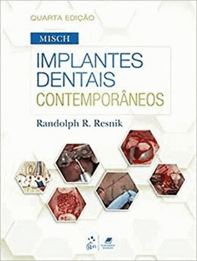 Misch - Implantes Dentais Contemporaneos