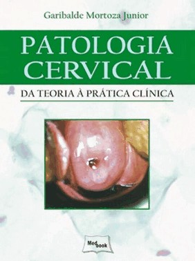 Patologia Cervical