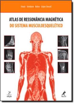 Atlas De Ressonancia Magnetica Do Sistema Musculoesqueletico